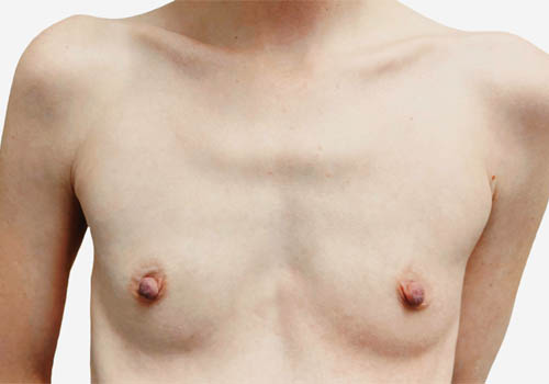 View Our Before & After Results
