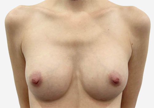 View Our Before & After Results