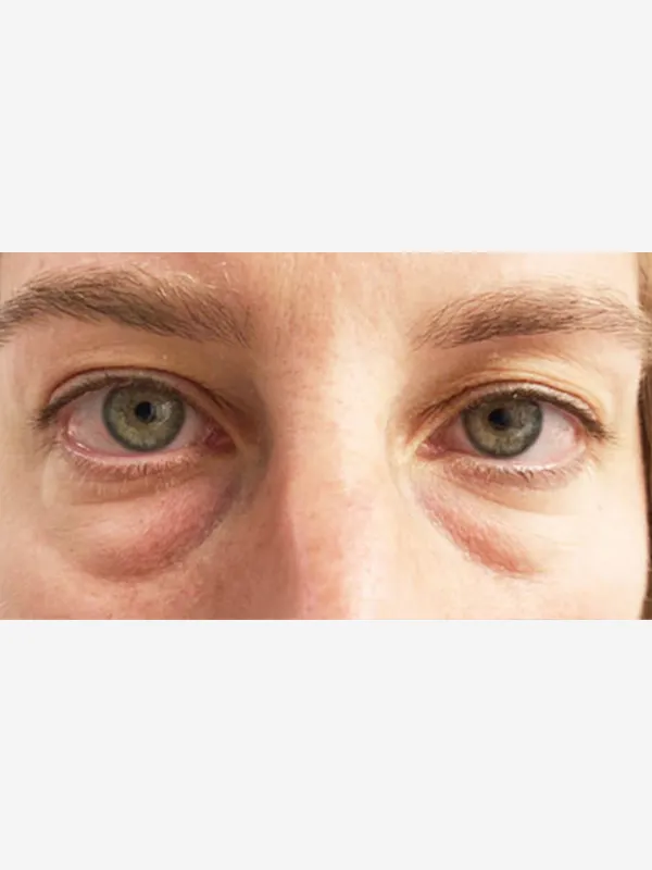 View Our Before & After Results